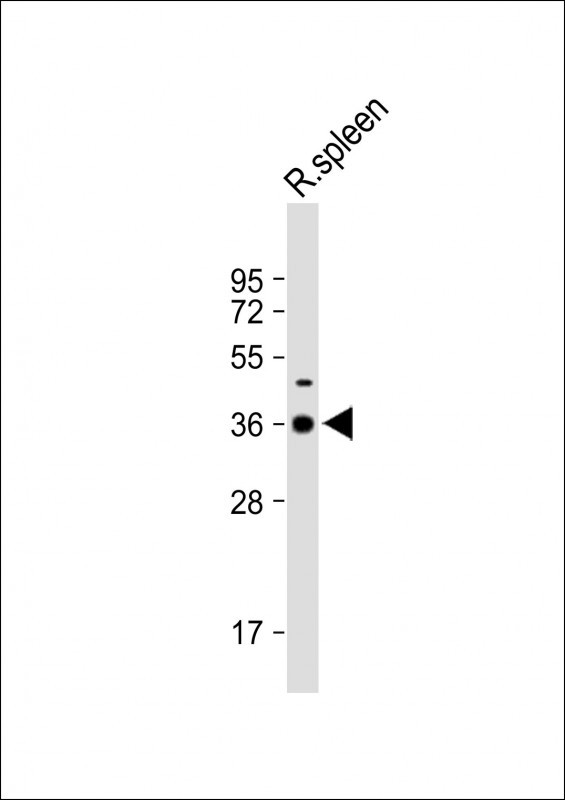 Anti-DNASE1L3 Antibody (N-term) at 1:2000 dilution + Rat spleen lysateLysates/proteins at 20 �g per lane. SecondaryGoat Anti-Rabbit IgG,  (H+L), Peroxidase conjugated at 1/10000 dilution. Predicted band size : 36 kDaBlocking/Dilution buffer: 5% NFDM/TBST.