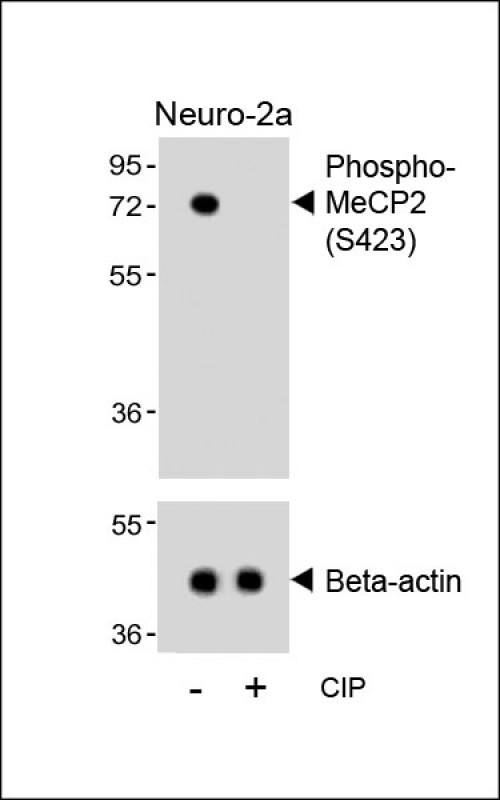 Western blot analysis of lysates from Neuro-2a cell line, untreated or treated with calf intestinal alkaline phosphatase(CIP), using Phospho-MeCP2(S423) Antibody(upper) or Beta-actin (lower).