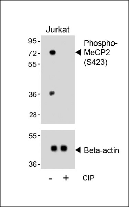 WB - Phospho-MeCP2(S423) Antibody AP3693a