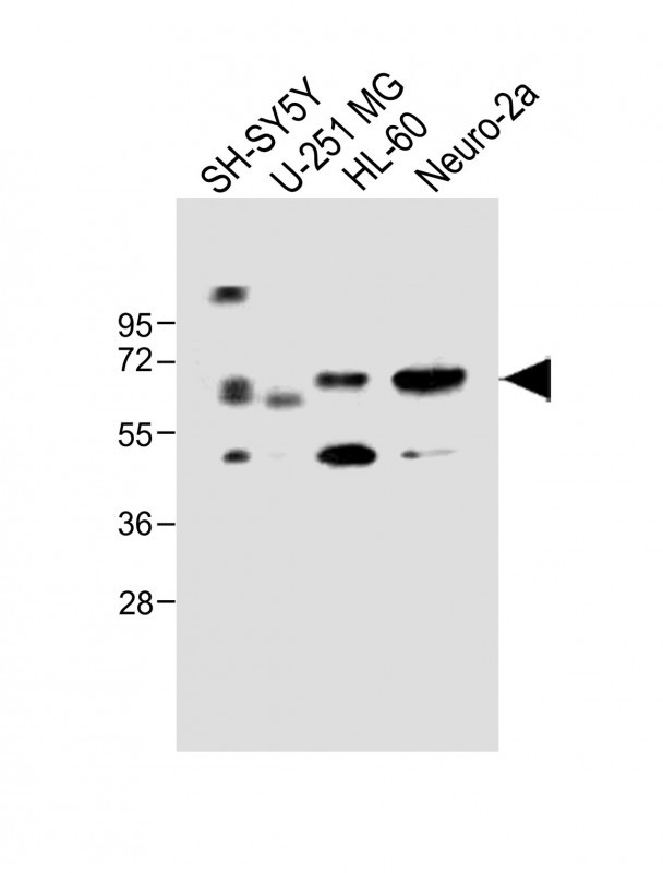 All lanes : Anti-CERK Antibody (C-term) at 1:1000 dilutionLane 1: SH-SY5Y whole cell lysateLane 2: U-251 MG whole cell lysateLane 3: HL-60 whole cell lysateLane 4: Neuro-2a whole cell lysateLysates/proteins at 20 �g per lane. SecondaryGoat Anti-Rabbit IgG,  (H+L), Peroxidase conjugated at 1/10000 dilution. Predicted band size : 60 kDaBlocking/Dilution buffer: 5% NFDM/TBST.