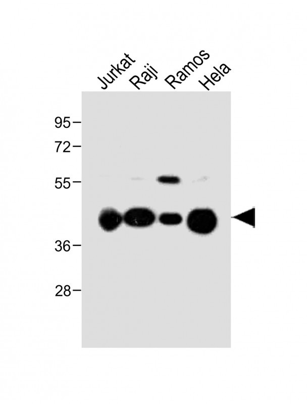 All lanes : Anti-HLA-G Antibody (Center) at 1:1000 dilutionLane 1: Jurkat whole cell lysateLane 2: Raji whole cell lysateLane 3: Ramos whole cell lysateLane 4: Hela whole cell lysateLysates/proteins at 20 �g per lane. SecondaryGoat Anti-Rabbit IgG,  (H+L), Peroxidase conjugated at 1/10000 dilution. Predicted band size : 38 kDaBlocking/Dilution buffer: 5% NFDM/TBST.