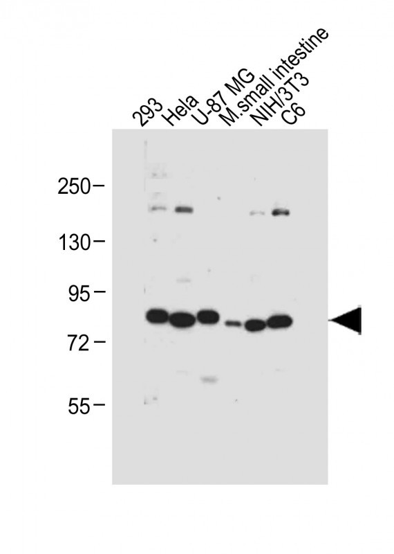 All lanes : Anti-cGKI (cGKI beta) Antibody (C-term) at 1:1000 dilutionLane 1: 293 whole cell lysateLane 2: Hela whole cell lysateLane 3: U-87 MG whole cell lysateLane 4: Mouse small intestine tissue lysateLane 5: NIH/3T3 whole cell lysateLane 6: C6 whole cell lysateLysates/proteins at 20 �g per lane. SecondaryGoat Anti-Rabbit IgG,  (H+L), Peroxidase conjugated at 1/10000 dilution. Predicted band size : 76 kDaBlocking/Dilution buffer: 5% NFDM/TBST.