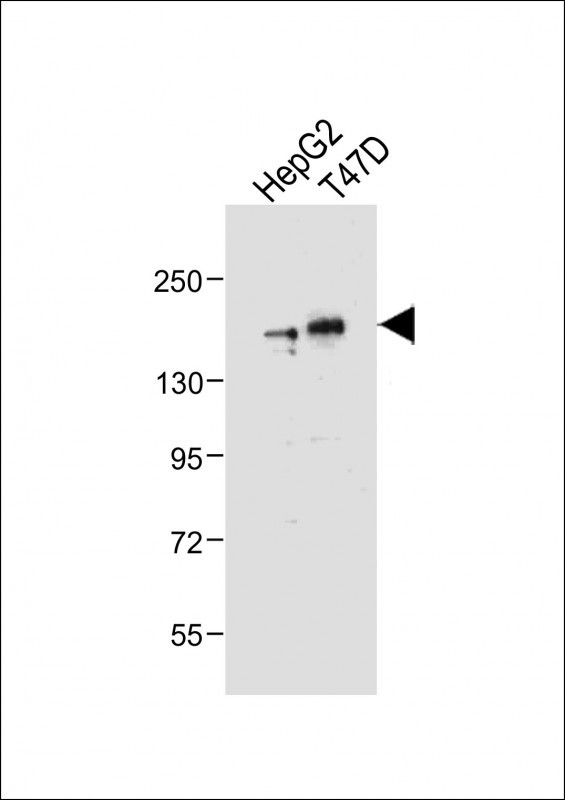 WB - HDAC6 Antibody (C-term) AP1106a