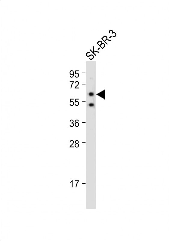 Anti-SLC15A3 Antibody (Center) at 1:2000 dilution + SK-BR-3 whole cell lysateLysates/proteins at 20 �g per lane. SecondaryGoat Anti-Rabbit IgG,  (H+L), Peroxidase conjugated at 1/10000 dilution. Predicted band size : 64 kDaBlocking/Dilution buffer: 5% NFDM/TBST.