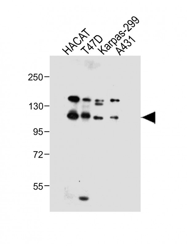 WB - MMRN2 Antibody (C-term) AP13047b