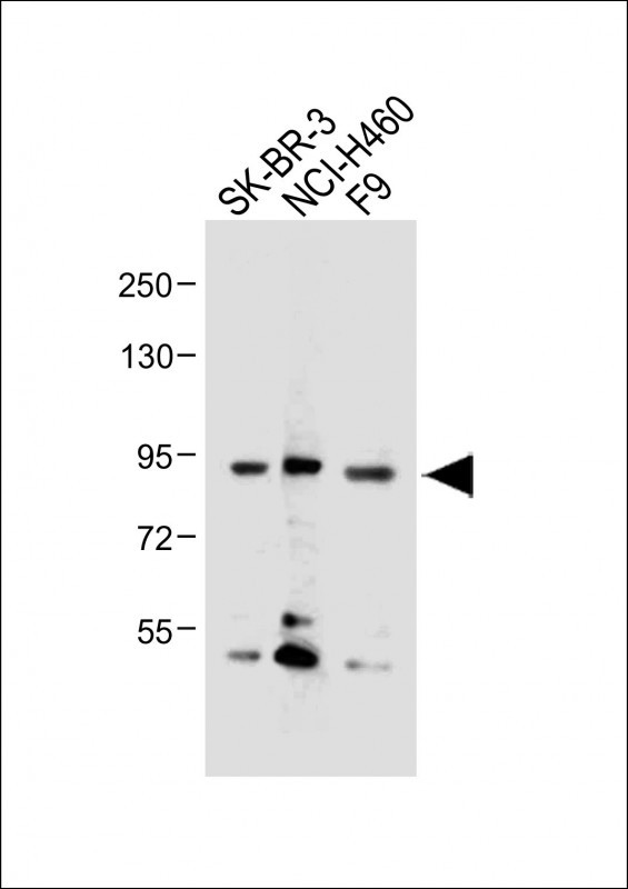 All lanes : Anti-CDH10 Antibody (C-term) at 1:2000 dilutionLane 1: SK-BR-3 whole cell lysateLane 2: NCI-H460 whole cell lysateLane 3: F9 whole cell lysateLysates/proteins at 20 �g per lane. SecondaryGoat Anti-Rabbit IgG,  (H+L), Peroxidase conjugated at 1/10000 dilution. Predicted band size : 88 kDaBlocking/Dilution buffer: 5% NFDM/TBST.