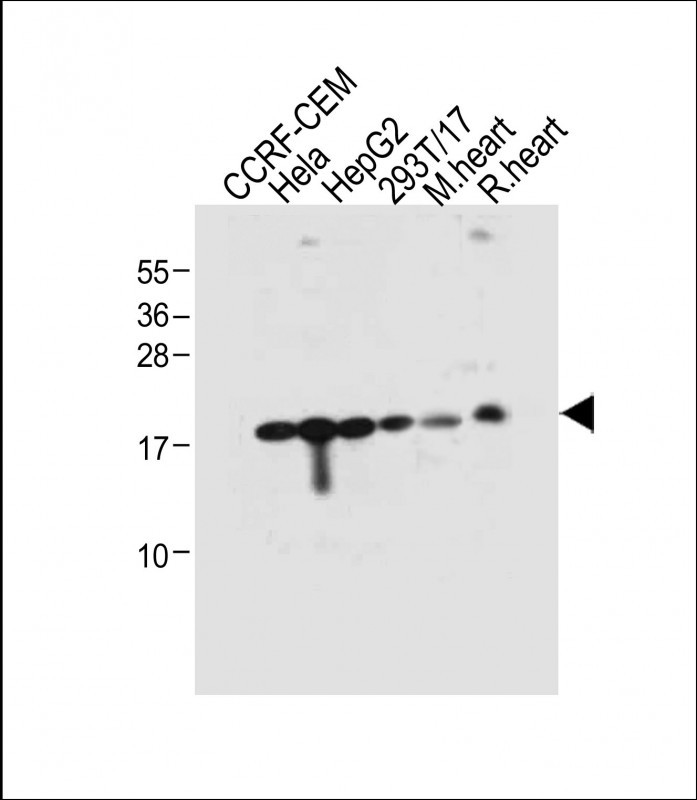 All lanes : Anti-RPL23A Antibody (C-term) at 1:2000 dilutionLane 1: CCRF-CEM whole cell lysateLane 2: Hela whole cell lysateLane 3: HepG2 whole cell lysateLane 4: 293T/17 whole cell lysateLane 5: Mouse heart tissue lysateLane 6: Rat heart tissue lysateLysates/proteins at 20 �g per lane. SecondaryGoat Anti-Rabbit IgG,  (H+L), Peroxidase conjugated at 1/10000 dilution. Predicted band size : 18 kDaBlocking/Dilution buffer: 5% NFDM/TBST.