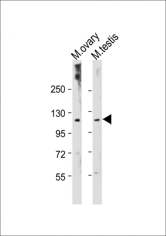 All lanes : Anti-Mouse Lats2 Antibody(C-term) at 1:2000 dilutionLane 1: Mouse ovary tissue lysateLane 2: Mouse testis tissue lysateLysates/proteins at 20 �g per lane. SecondaryGoat Anti-Rabbit IgG,  (H+L), Peroxidase conjugated at 1/10000 dilution. Predicted band size : 115 kDaBlocking/Dilution buffer: 5% NFDM/TBST.