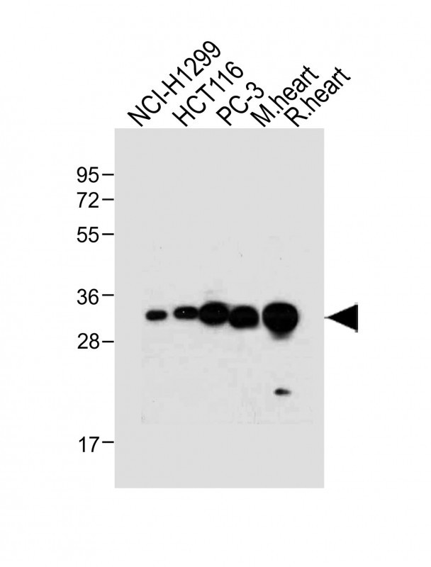 All lanes : Anti-VDAC2 Antibody (N-term) at 1:4000 dilutionLane 1: NCI-H1299 whole cell lysateLane 2: HCT116 whole cell lysateLane 3: PC-3 whole cell lysateLane 4: Mouse heart tissue lysateLane 5: Rat heart tissue lysateLysates/proteins at 20 �g per lane. SecondaryGoat Anti-Rabbit IgG,  (H+L), Peroxidase conjugated at 1/10000 dilution. Predicted band size : 32 kDaBlocking/Dilution buffer: 5% NFDM/TBST.
