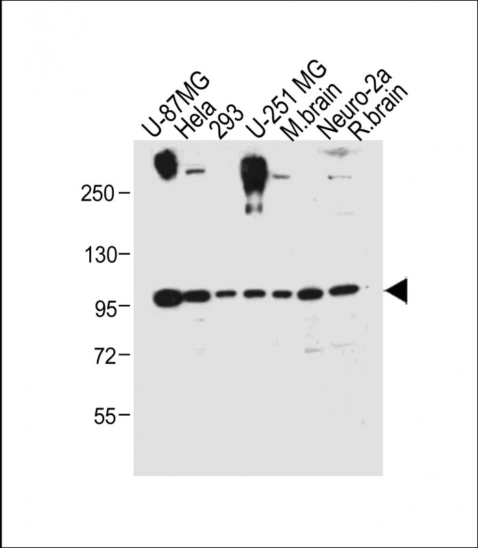 All lanes : Anti-FGFR(Y766) Antibody at 1:1000 dilutionLane 1: U-87MG whole cell lysateLane 2: Hela whole cell lysateLane 3: 293 whole cell lysateLane 4: U-251 MG whole cell lysateLane 5: Mouse brain tissue lysateLane 6: Neuro-2a whole cell lysateLane 7: Rat brain tissue lysateLysates/proteins at 20 �g per lane. SecondaryGoat Anti-Rabbit IgG,  (H+L), Peroxidase conjugated at 1/10000 dilution. Predicted band size : 92 kDaBlocking/Dilution buffer: 5% NFDM/TBST.