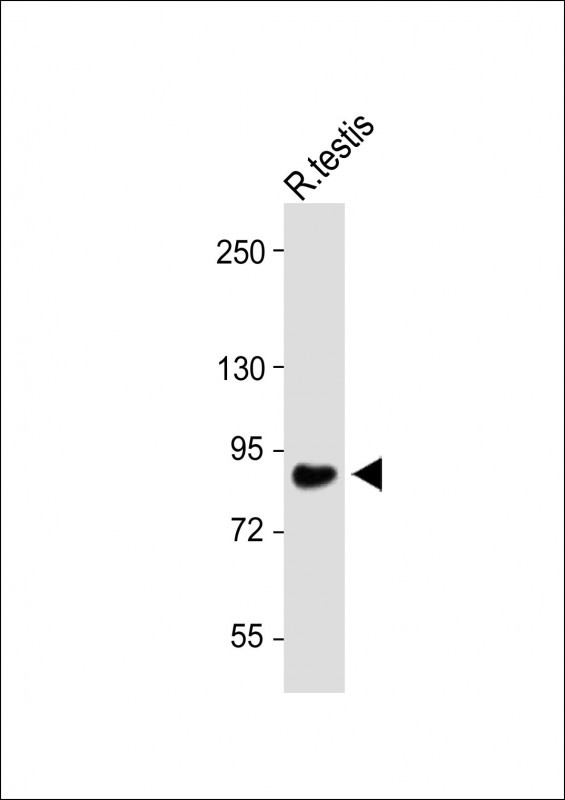 Anti-WDR48_HUMAN at 1:1000 dilution + Rat testis lysateLysates/proteins at 20 �g per lane. SecondaryGoat Anti-Rabbit IgG,  (H+L), Peroxidase conjugated at 1/10000 dilution. Predicted band size : 76 kDaBlocking/Dilution buffer: 5% NFDM/TBST.