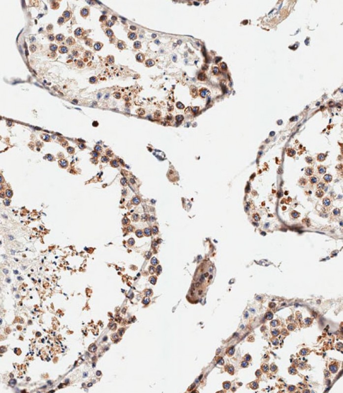 IHC-P-Leica - IFITM5 Antibody (Center) AP11058c