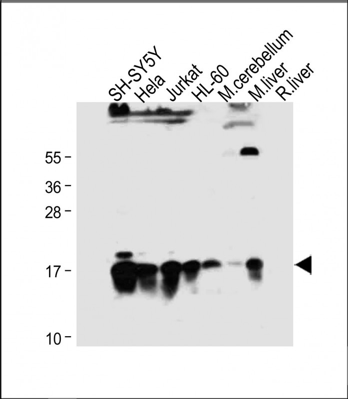 WB - SUMO2/3 Antibody (C-term) AP1224a
