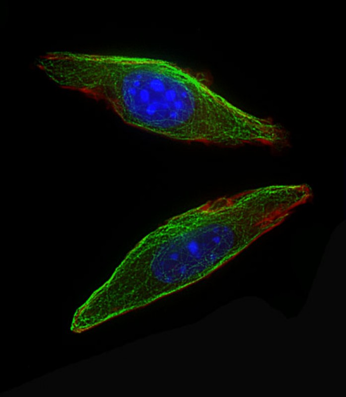 Immunofluorescent analysis of 4% paraformaldehyde-fixed,  0. 1% Triton X-100 permeabilized NIH/3T3 cells labeling Csf1r with AP13911B at 1/25 dilution, followed by Dylight� 488-conjugated goat anti-Rabbit IgG secondary antibody at 1/200 dilution (green). Immunofluorescence image showing Cytoplasm staining on NIH/3T3 cell line.  Cytoplasmic actin is detected with Dylight� 554 Phalloidin(red). The nuclear counter stain is DAPI (blue).