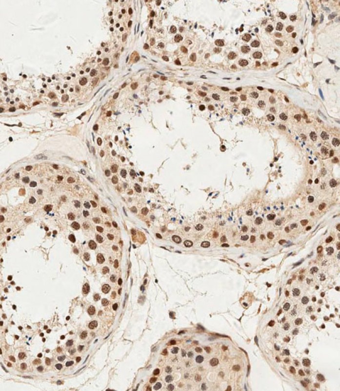 IHC-P - ALKBH5 Antibody (Center) AP18410c