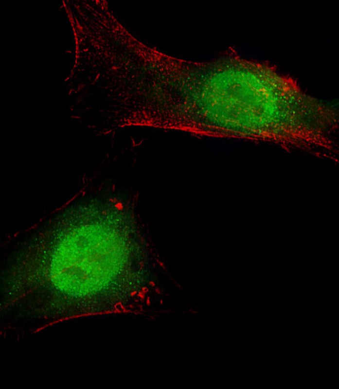 Immunofluorescent analysis of 4% paraformaldehyde-fixed,  0. 1% Triton X-100 permeabilized Hela cells labeling BAP1 with AP2168a at 1/25 dilution, followed by Dylight� 488-conjugated goat anti-Rabbit IgG secondary antibody at 1/200 dilution (green). Immunofluorescence image showing  Nucleus and Weak Cytoplasm staining on Hela cell line.  Cytoplasmic actin is detected with Dylight� 554 Phalloidin(red). The nuclear counter stain is DAPI (blue).