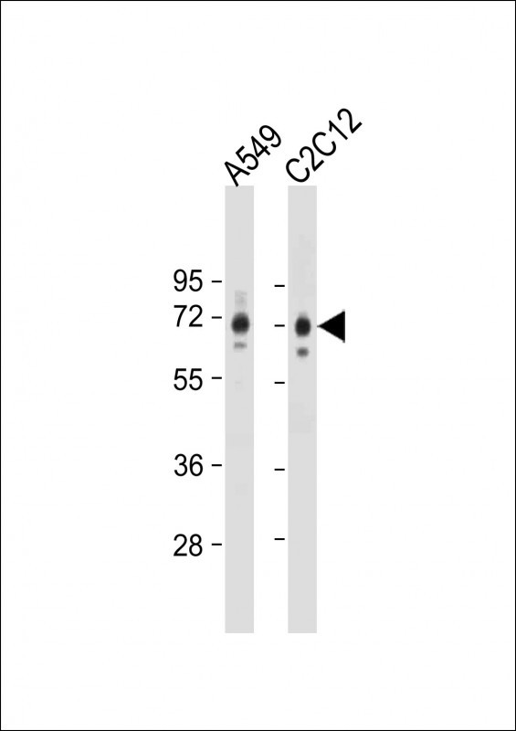 WB - SQSTM1 (p62) Antibody (C-term) AP2183B