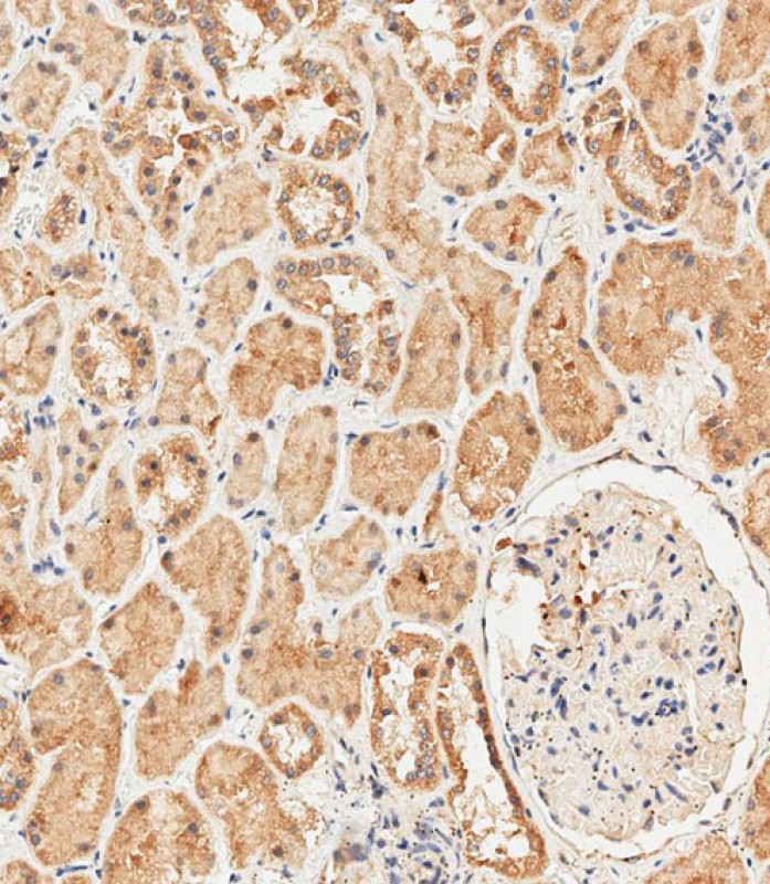 IHC-P-Leica - RS18 Antibody (Center) AP6887c