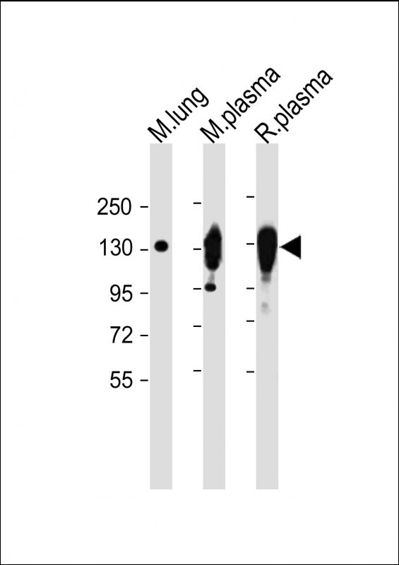 All lanes : Anti-CP Antibody (Center) at 1:2000 dilutionLane 1: Mouse lung lysateLane 2: Mouse plasma lysateLane 3: Rat plasma lysateLysates/proteins at 20 �g per lane. SecondaryGoat Anti-Rabbit IgG,  (H+L), Peroxidase conjugated at 1/10000 dilution. Predicted band size : 122 kDaBlocking/Dilution buffer: 5% NFDM/TBST.