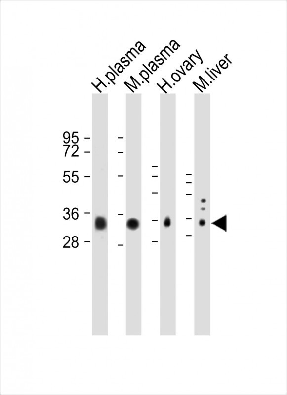 All lanes : Anti-APOE Antibody (C-term) at 1:1000 dilutionLane 1: Human plasma lysateLane 2: Mouse plasma lysateLane 3: Human ovary lysateLane 4: Mouse liver lysate    Lysates/proteins at 20 �g per lane. SecondaryGoat Anti-Rabbit IgG,  (H+L), Peroxidase conjugated at 1/10000 dilution. Predicted band size : 36 kDaBlocking/Dilution buffer: 5% NFDM/TBST.