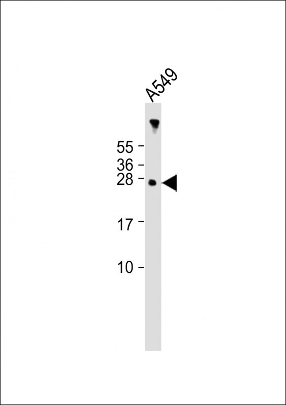 Anti-AANAT Antibody (N-term) at 1:2000 dilution + A549 whole cell lysateLysates/proteins at 20 �g per lane. SecondaryGoat Anti-Rabbit IgG,  (H+L), Peroxidase conjugated at 1/10000 dilution. Predicted band size : 23 kDaBlocking/Dilution buffer: 5% NFDM/TBST.