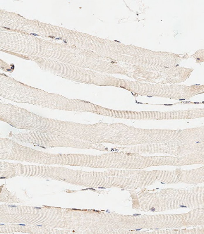 IHC-P-Leica - HYAL4 Antibody (Center) AP13683C