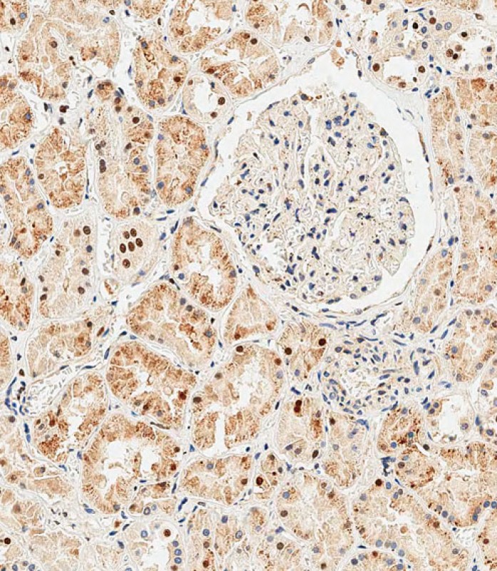 IHC-P-Leica - GLI2 Antibody (C-term) AP20619c