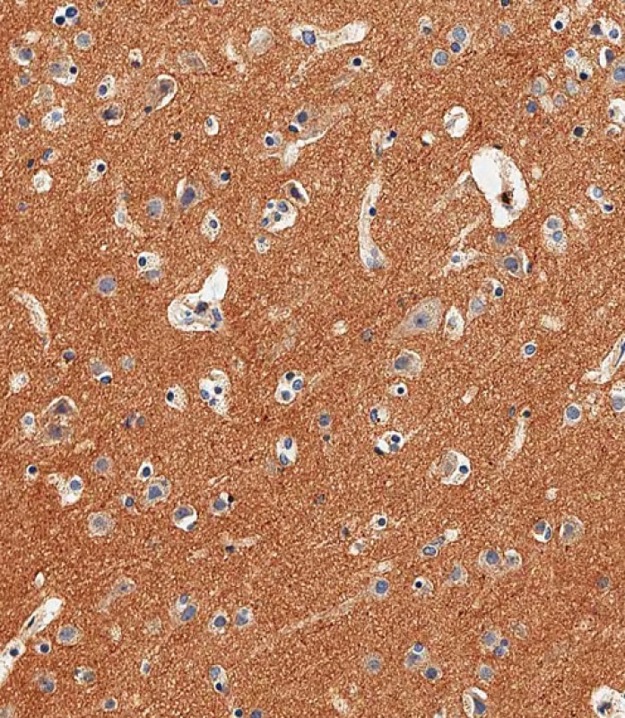 IHC-P-Leica - NCAM1 Antibody (C-term) AP20927c