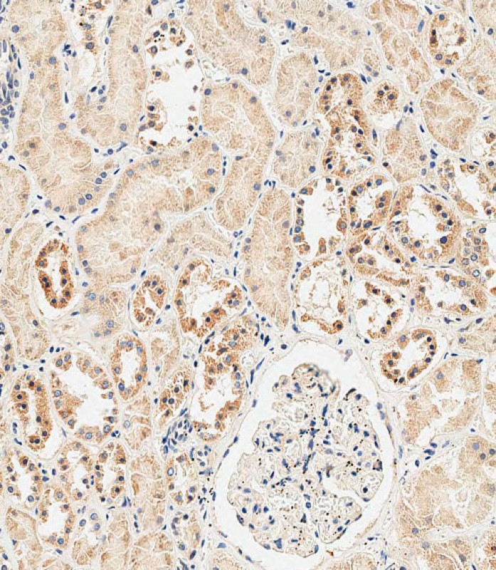 IHC-P-Leica - GLS Antibody (C-term) AP8809B