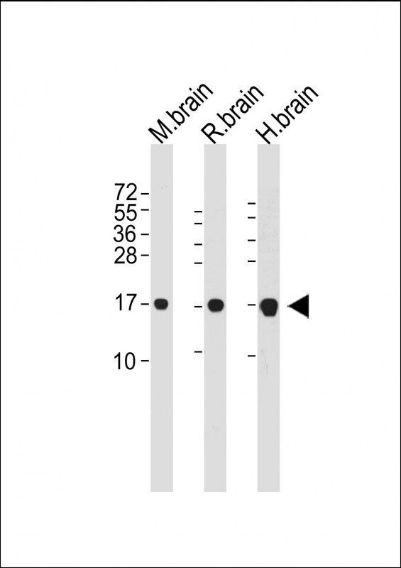 WB - LC3 Antibody (APG8) AM1800A