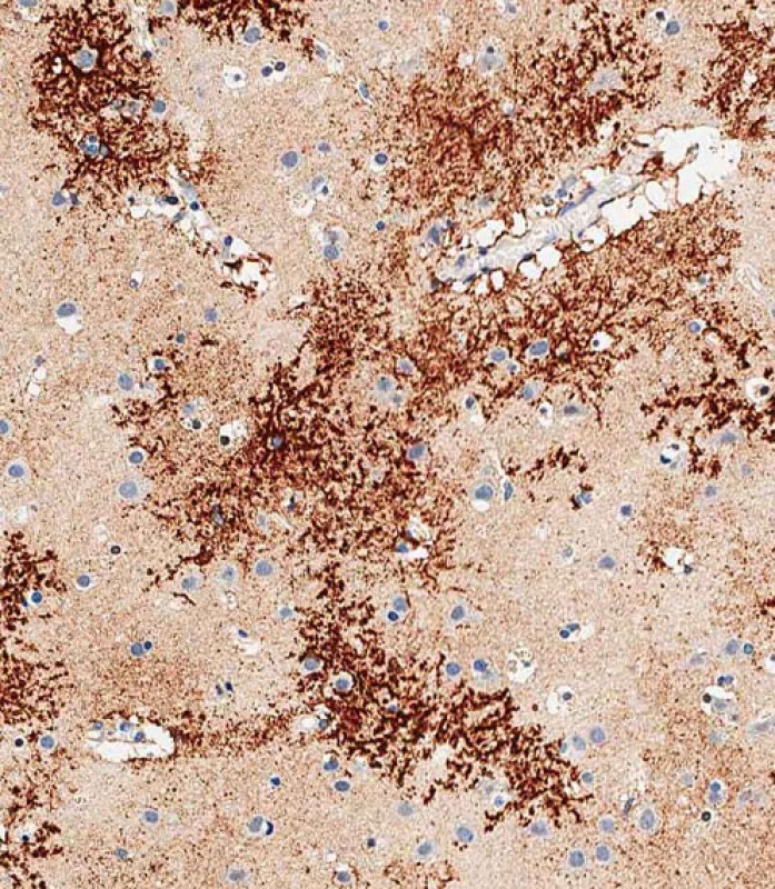 IHC-P-Leica - OTUD3 Antibody (Center) AP11031C