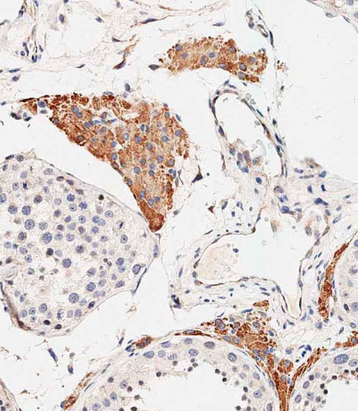 IHC-P-Leica - OTUD3 Antibody (Center) AP11031C