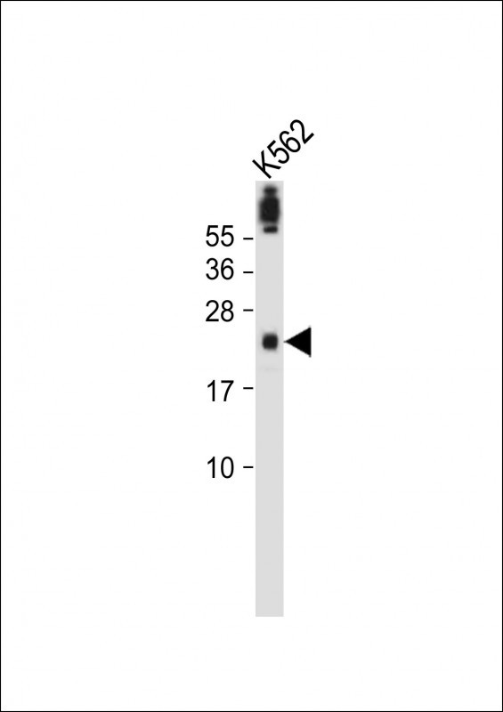 WB - FA96A Antibody  (C-term) AP11250b