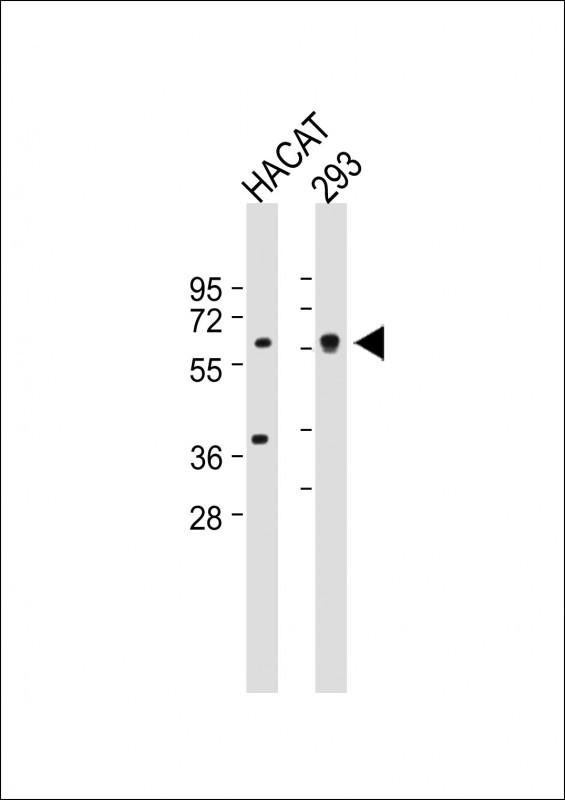 All lanes : Anti-SGPL1 Antibody (N-term) at 1:1000 dilutionLane 1: HACAT whole cell lysateLane 2: 293 whole cell lysateLysates/proteins at 20 �g per lane. SecondaryGoat Anti-Rabbit IgG,  (H+L), Peroxidase conjugated at 1/10000 dilution. Predicted band size : 64 kDaBlocking/Dilution buffer: 5% NFDM/TBST.