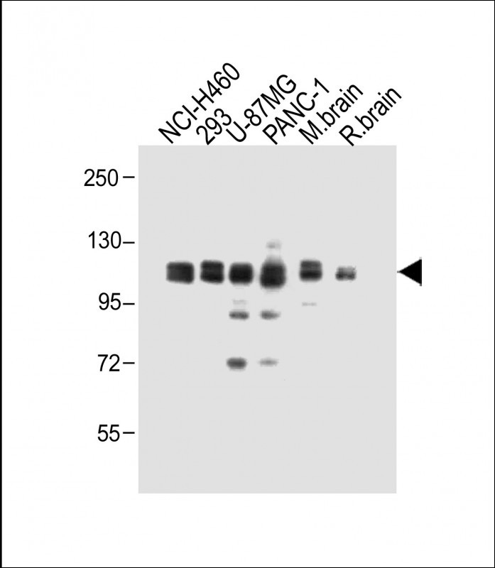 WB - XYLT1 Antibody (N-term) AP12779a