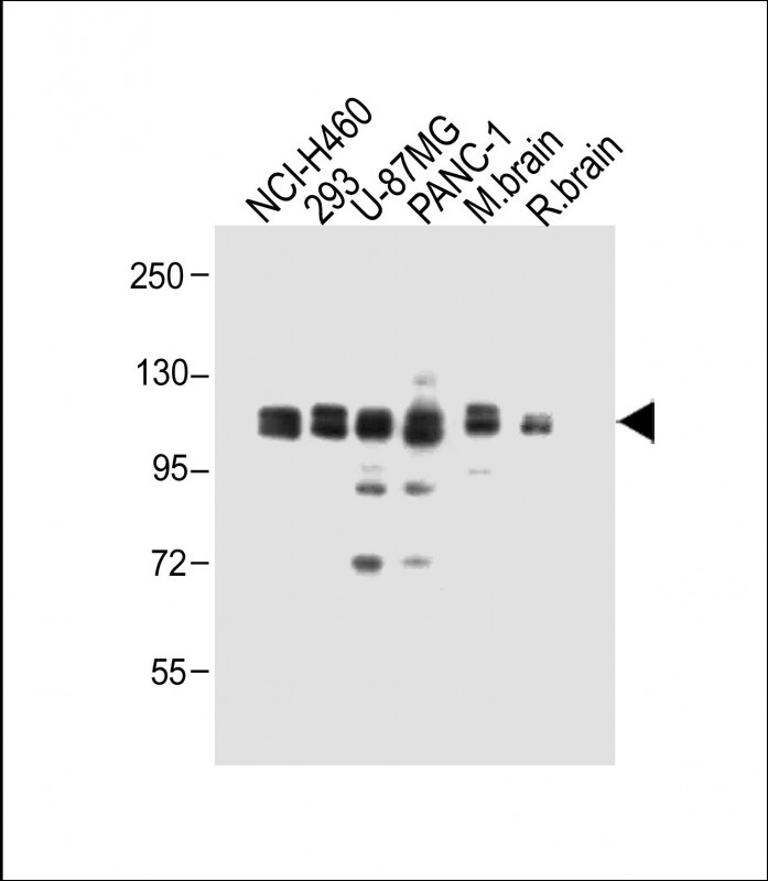 All lanes : Anti-XYLT1 Antibody (N-term) at 1:1000 dilutionLane 1: NCI-H460 whole cell lysateLane 2: 293 whole cell lysateLane 3: U-87MG whole cell lysateLane 4: PANC-1 whole cell lysateLane 5: Mouse brain whole cell lysateLane 6: Rat brain whole cell lysateLysates/proteins at 20 �g per lane. SecondaryGoat Anti-Rabbit IgG,  (H+L), Peroxidase conjugated at 1/10000 dilution. Predicted band size : 108 kDaBlocking/Dilution buffer: 5% NFDM/TBST.