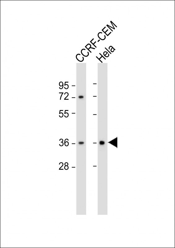 WB - PITX2 Antibody (C-term) AP1429b