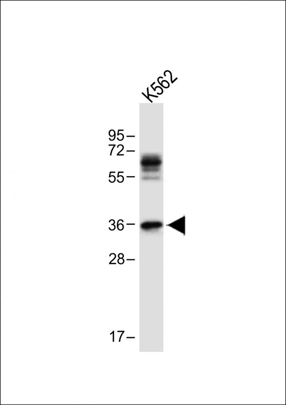 WB - PITX2 Antibody (C-term) AP1429b