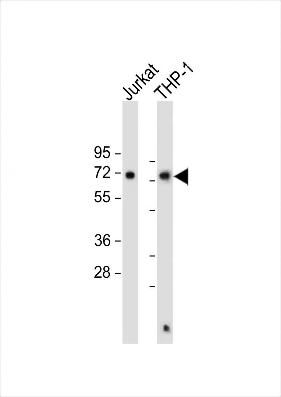 WB - SQSTM1 (p62) Antibody (C-term) AP2183B