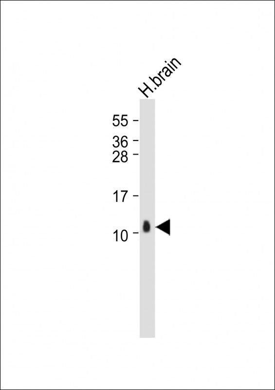 Anti-S100B Antibody at 1:2000 dilution + Human brain whole tissue lysateLysates/proteins at 20 �g per lane. SecondaryGoat Anti-Rabbit IgG,  (H+L), Peroxidase conjugated at 1/10000 dilution. Predicted band size : 11 kDaBlocking/Dilution buffer: 5% NFDM/TBST.