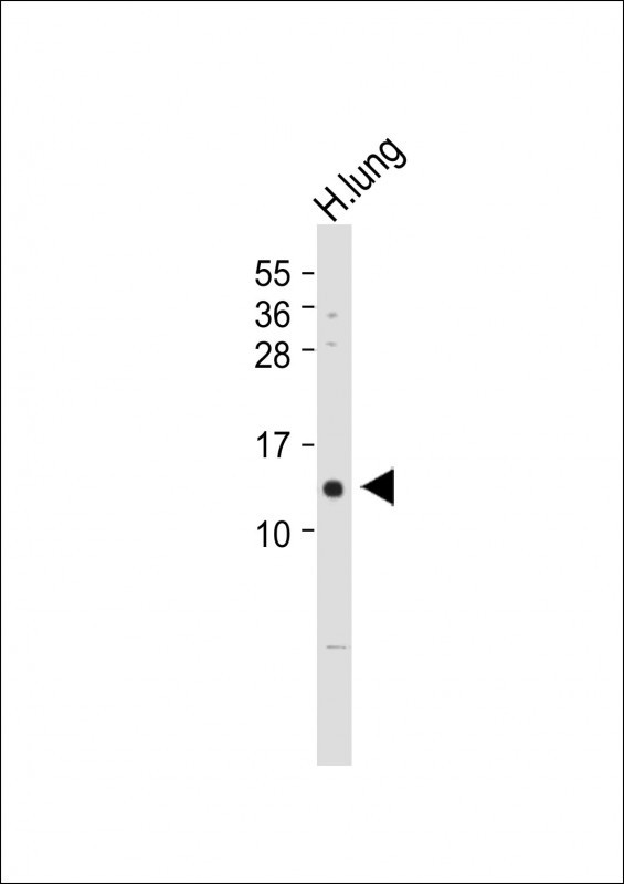 WB - VKORC1 Antibody (N-term) AP5859A