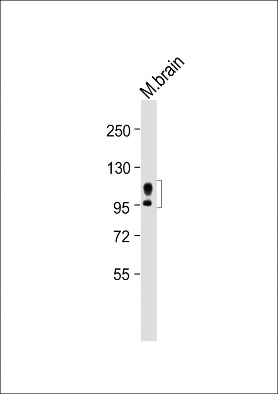 Anti-hAPP-H44 at 1?1000 dilution + Mouse brain whole tissue  lysateLysates/proteins at 20 �g per lane. SecondaryGoat Anti-Rabbit IgG,  (H+L), Peroxidase conjugated at 1/10000 dilution. Predicted band size : 87 kDaBlocking/Dilution buffer: 5% NFDM/TBST.