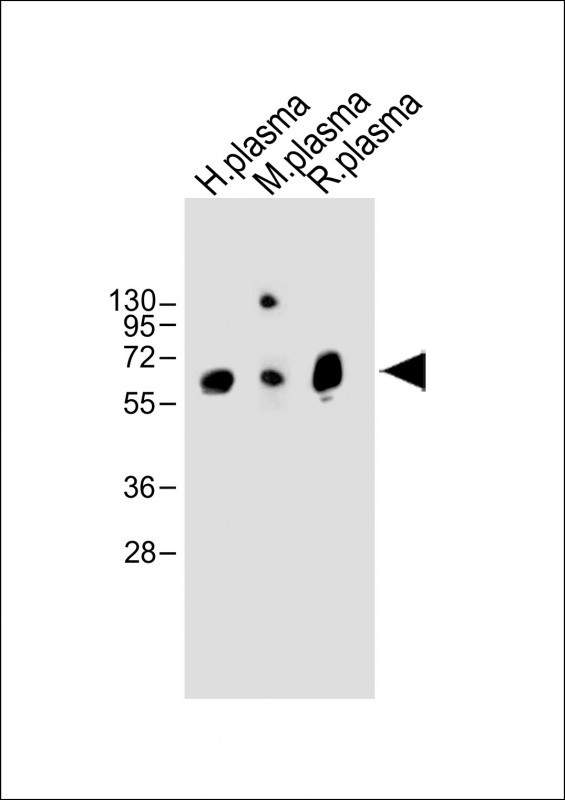 All lanes : Anti-TPA Antibody (Center) at 1:2000 dilutionLane 1: Human plasma whole  lysateLane 2: Mouse plasma whole lysateLane 3: Rat plasma whole lysateLysates/proteins at 20 �g per lane. SecondaryGoat Anti-Rabbit IgG,  (H+L), Peroxidase conjugated at 1/10000 dilution. Predicted band size : 63 kDaBlocking/Dilution buffer: 5% NFDM/TBST.