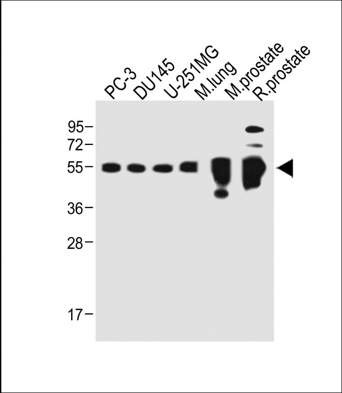 All lanes : Anti-ACPP Antibody (C-term) at 1:500 dilutionLane 1: PC-3 whole cell lysateLane 2: DU145 whole cell lysateLane 3: U-251MG whole cell lysateLane 4: Mouse lung whole tissue lysateLane 5: Mouse prostate whole tissue lysateLane 5: Rat prostate whole tissue lysateLysates/proteins at 20 �g per lane. SecondaryGoat Anti-Rabbit IgG,  (H+L), Peroxidase conjugated at 1/10000 dilution. Predicted band size : 45 kDaBlocking/Dilution buffer: 5% NFDM/TBST.