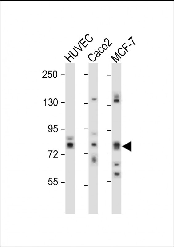 All lanes : Anti-cGKII Antibody (C-term) at 1:1000 dilutionLane 1: HUVEC  whole cell lysateLane 2: Caco2 whole cell lysateLane 3: MCF-7 whole cell lysateLysates/proteins at 20 �g per lane. SecondaryGoat Anti-Rabbit IgG,  (H+L), Peroxidase conjugated at 1/10000 dilution. Predicted band size : 87 kDaBlocking/Dilution buffer: 5% NFDM/TBST.