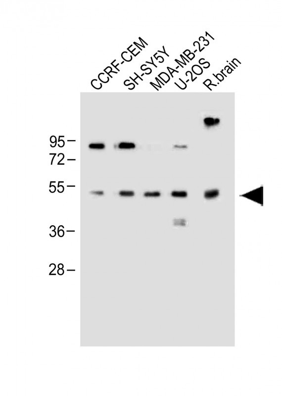 WB - EDIL3 Antibody (Center) AP9005c