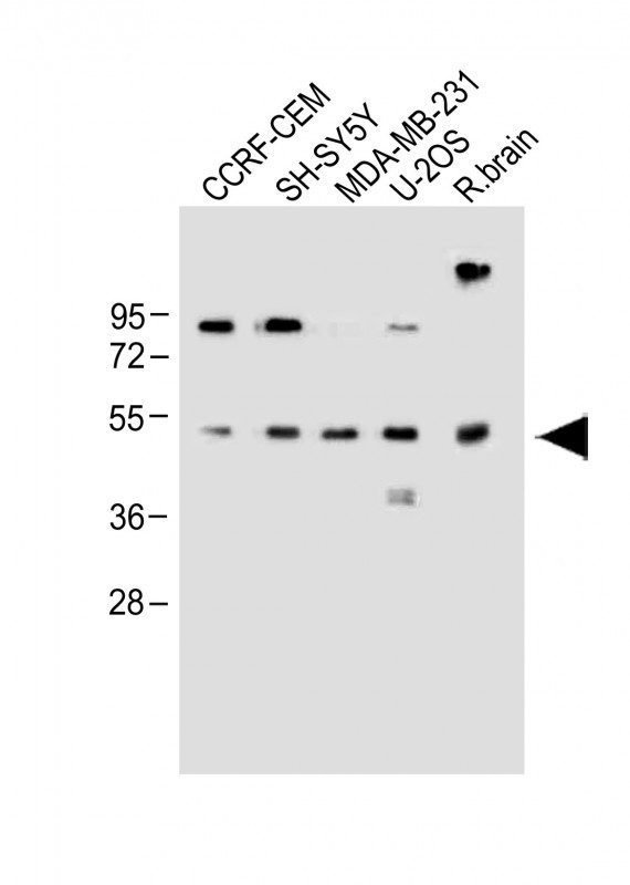 All lanes : Anti-EDIL3 Antibody (Center) at 1:1000 dilutionLane 1: CCRF-CEM  whole cell lysateLane 2: SH-SY5Y whole cell lysateLane 3: MDA-MB-231 whole cell lysateLane 4: U-2OS whole cell lysateLane 5: Rat brain whole lysateLysates/proteins at 20 �g per lane.  SecondaryGoat Anti-Rabbit IgG,   (H+L),  Peroxidase conjugated at 1/10000 dilution.  Predicted band size : 54 kDaBlocking/Dilution buffer: 5% NFDM/TBST.