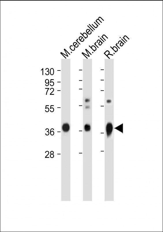 All lanes : Anti-GNAO1 Antibody (C-term) at 1:2000 dilutionLane 1: Mouse cerebellum whole  lysateLane 2: Mouse brain whole  lysateLane 3: Rat brain whole  lysateLysates/proteins at 20 �g per lane. SecondaryGoat Anti-Rabbit IgG,  (H+L), Peroxidase conjugated at 1/10000 dilution. Predicted band size : 40 kDaBlocking/Dilution buffer: 5% NFDM/TBST.