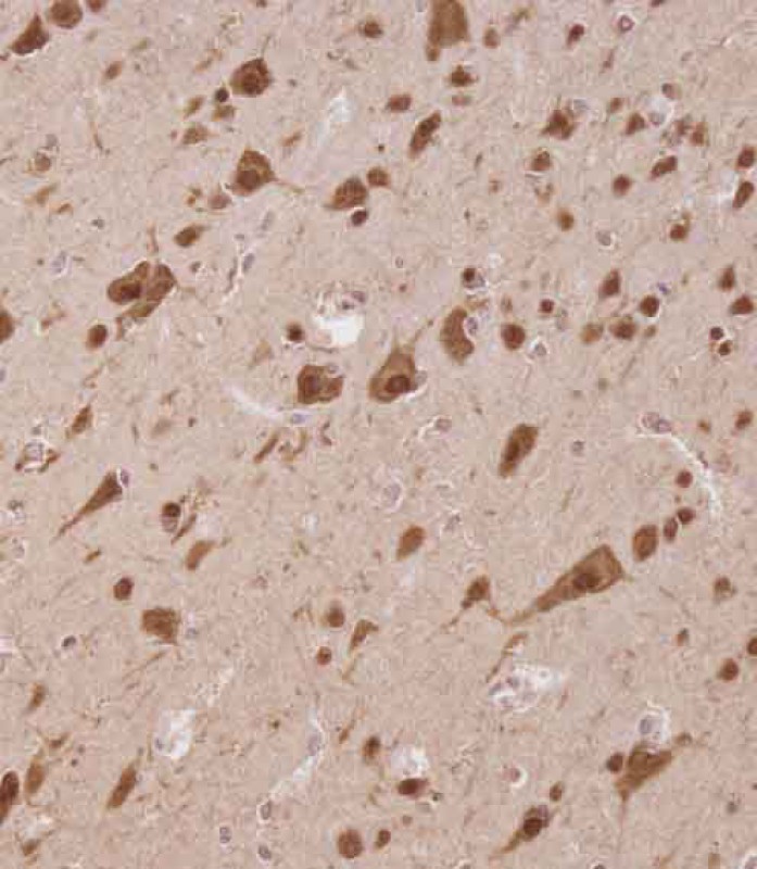 IHC-P - ELAVL2 Antibody (Center) AP12937c