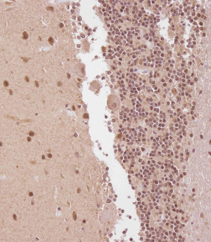 IHC-P - ELAVL2 Antibody (Center) AP12937c